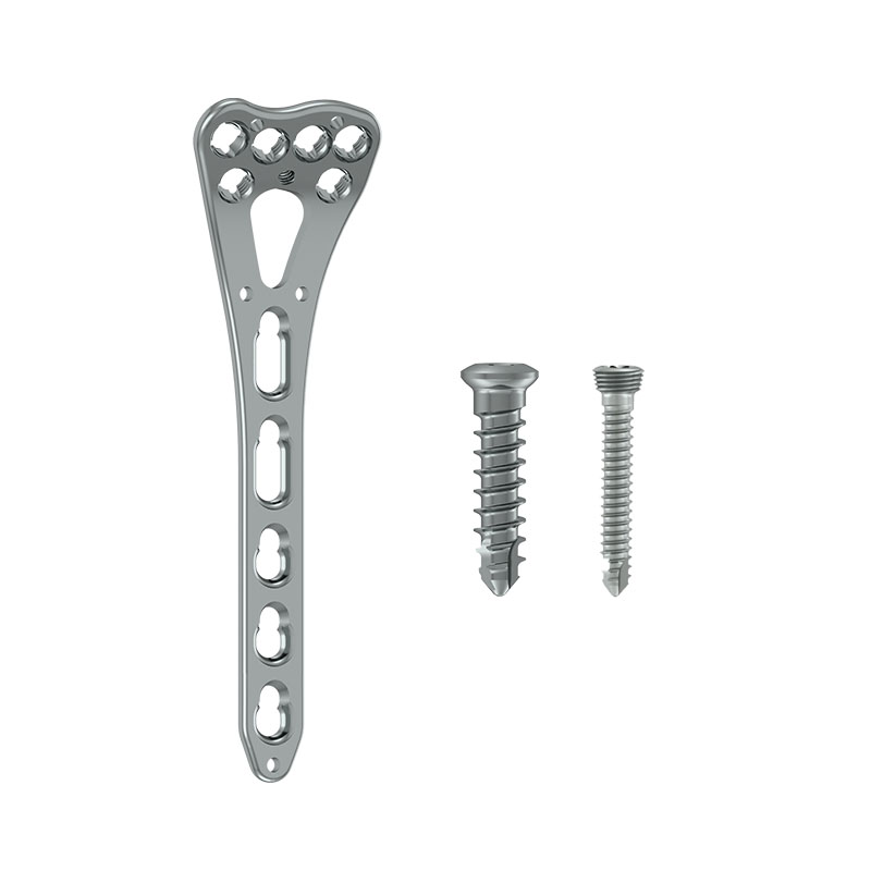 Distal Radius Locking Plate